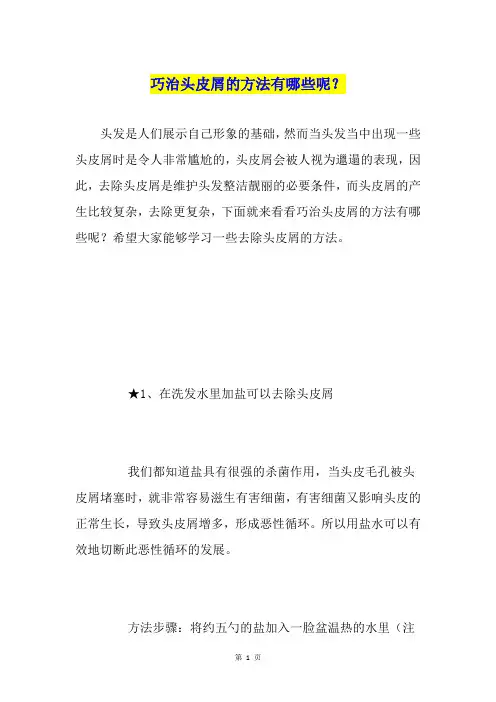 巧治头皮屑的方法有哪些呢？
