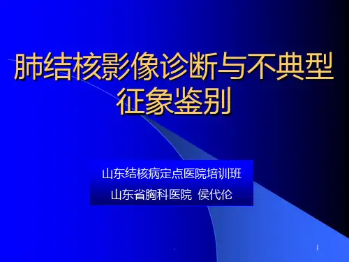 肺结核影像诊断与不典型征象鉴别ppt课件