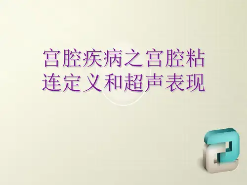 宫腔疾病之宫腔粘连定义和超声表现