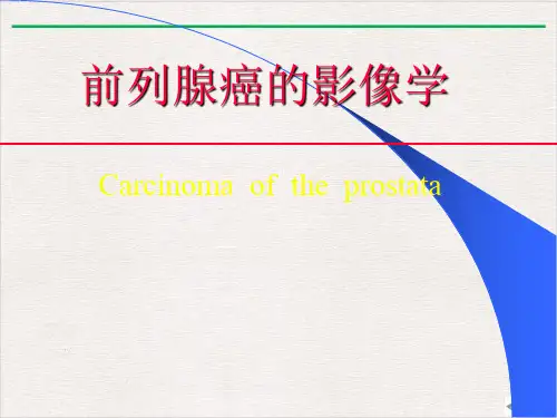 盆腔的影像学诊断课件PPT
