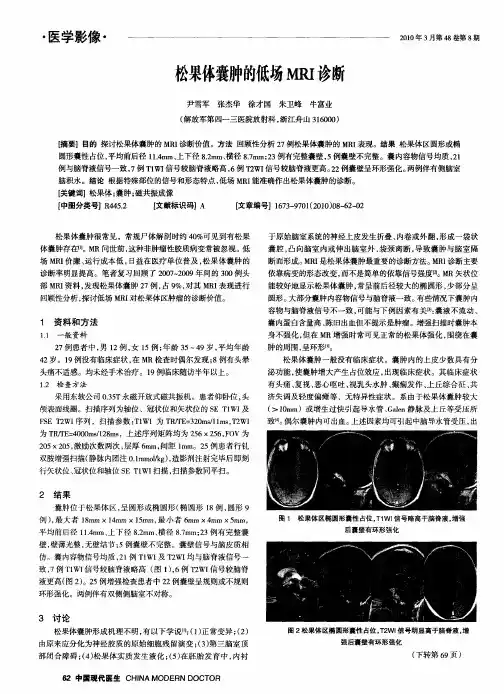 松果体囊肿的低场MRI诊断