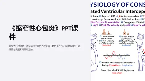 《缩窄性心包炎》课件
