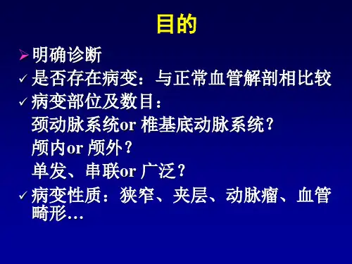 脑血管造影流程图