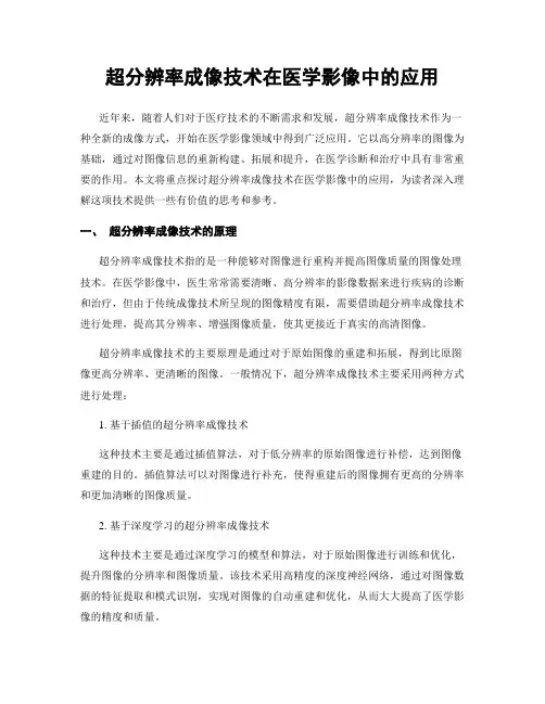 超分辨率成像技术在医学影像中的应用