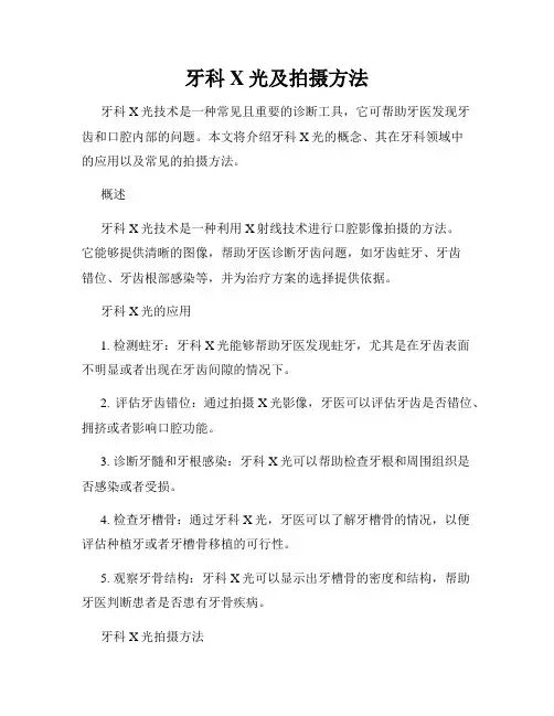 牙科X光及拍摄方法