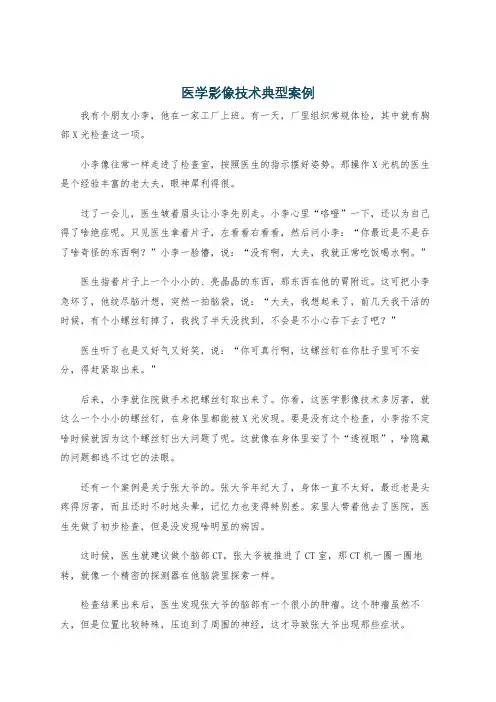 医学影像技术典型案例