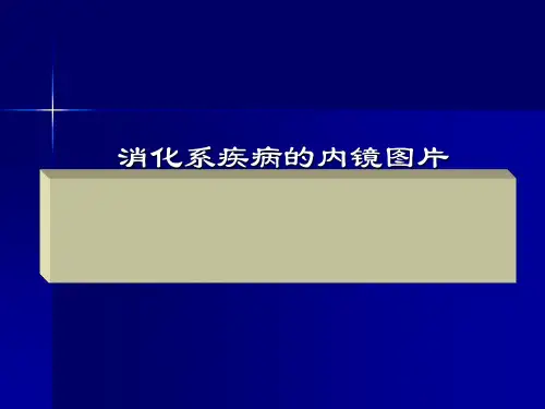 胃镜常见病教学图片ppt课件