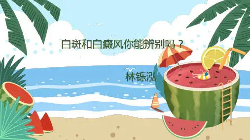 白斑和白癜风你能辨别吗？