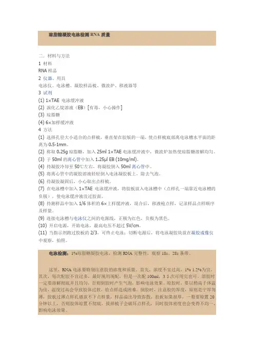 琼脂糖凝胶电泳检测RNA质量