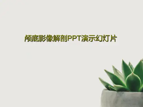颅底影像解剖PPT演示幻灯片共44页PPT