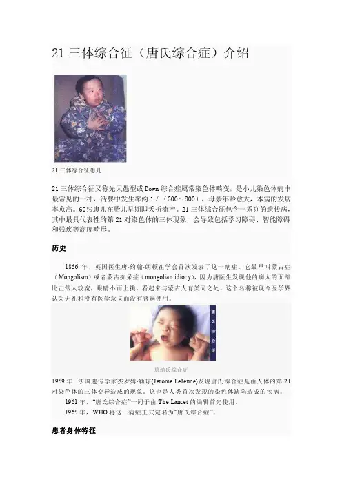 [生物]【教学论文】21三体综合征]唐氏综合症[介绍唐氏综合症【教师职称评..