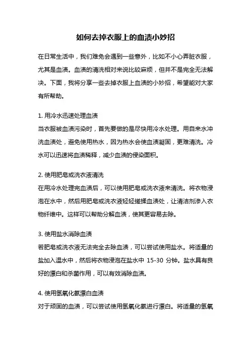 如何去掉衣服上的血渍小妙招