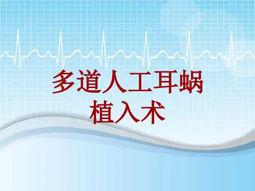 手术讲解模板：多道人工耳蜗植入术