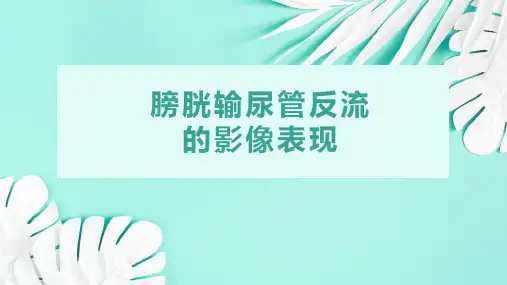 膀胱输尿管反流的影像诊断