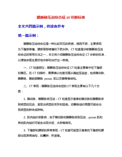 髂静脉压迫综合征ct诊断标准