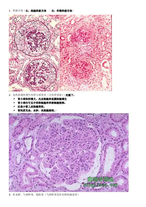 病理学切片复习