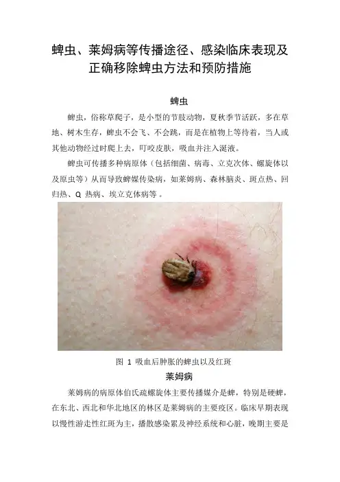 蜱虫、莱姆病等传播途径、感染临床表现及正确移除蜱虫方法和预防措施