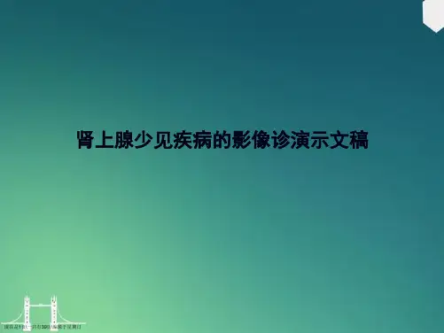 肾上腺少见疾病的影像诊演示文稿