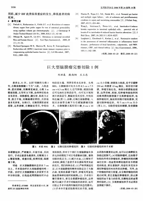 巨大型脑膜瘤完整切除1例