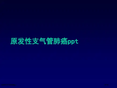 原发性支气管肺癌