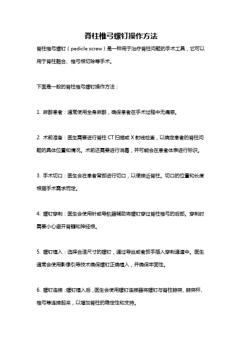 脊柱椎弓螺钉操作方法