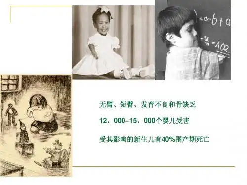 沙利度胺在风湿病中的应用-PPT文档
