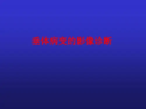 推荐垂体病变的影像诊断课件