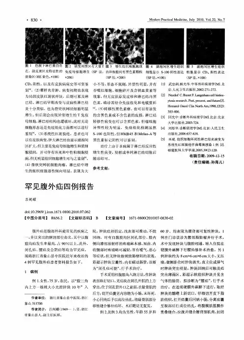罕见腹外疝四例报告
