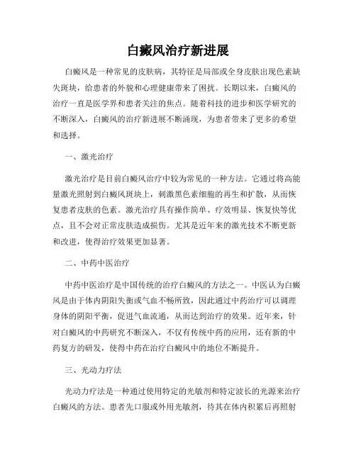 白癜风治疗新进展