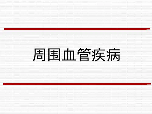 周围血管病PPT课件