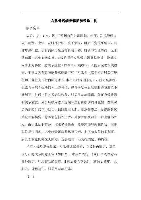 右肱骨远端骨骺损伤误诊1例论文