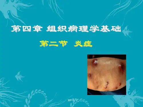 第四章-组织病理学基础-炎症  ppt课件