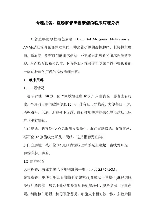 直肠肛管黑色素瘤诊治体会