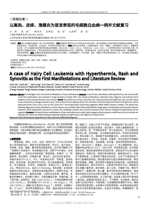 以高热、皮疹、滑膜炎为首发表现的毛细胞白血病一例并文献复习