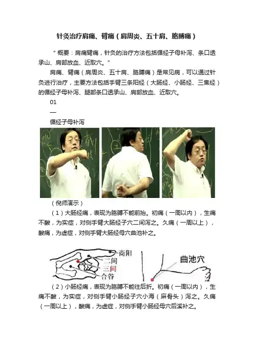针灸治疗肩痛、臂痛（肩周炎、五十肩、胳膊痛）