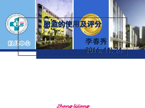 胎心监护课件 PPT