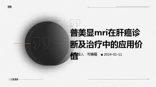 普美显MRI在肝癌诊断及治疗中的应用价值
