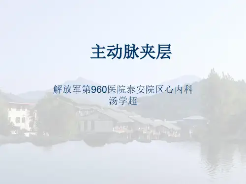 主动脉夹层诊断和治疗指南