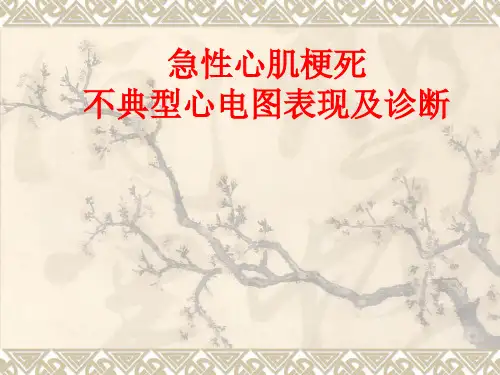 急性心肌梗死不典型心电图表现