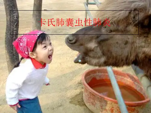 卡氏肺囊虫性肺炎PCP影像学诊断课件