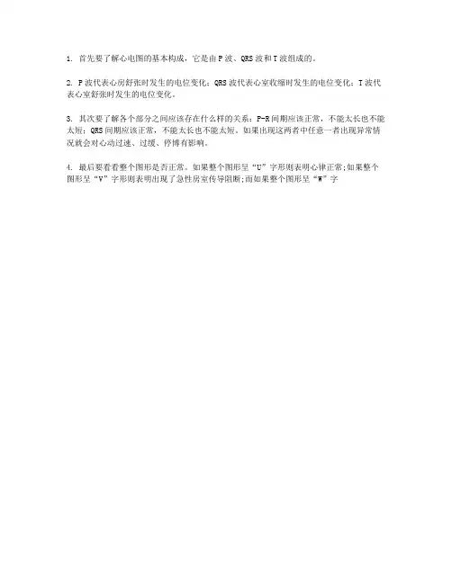 看懂心电图的简单方法