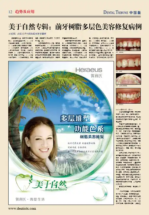 美于自然专辑前牙树脂多层色美容修复病例