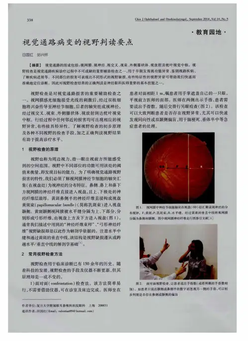 视觉通路病变的视野判读要点