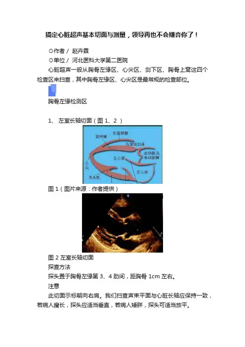 搞定心脏超声基本切面与测量，领导再也不会嫌弃你了！
