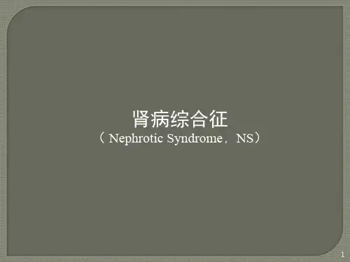 肾病综合征新ppt课件