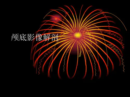 颅底影像解剖