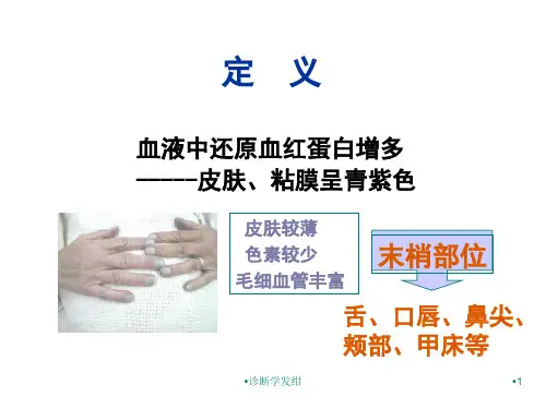 诊断学发绀课件