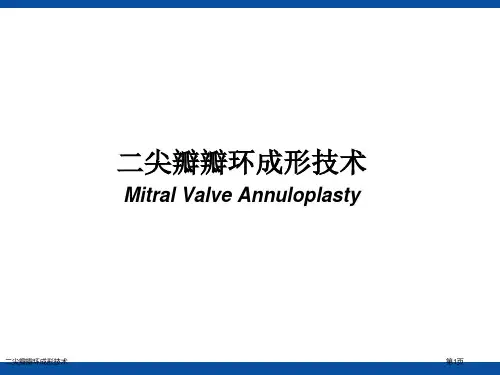 二尖瓣瓣环成形技术
