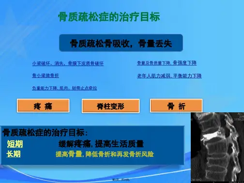 骨质疏松全程管理(加MCC)
