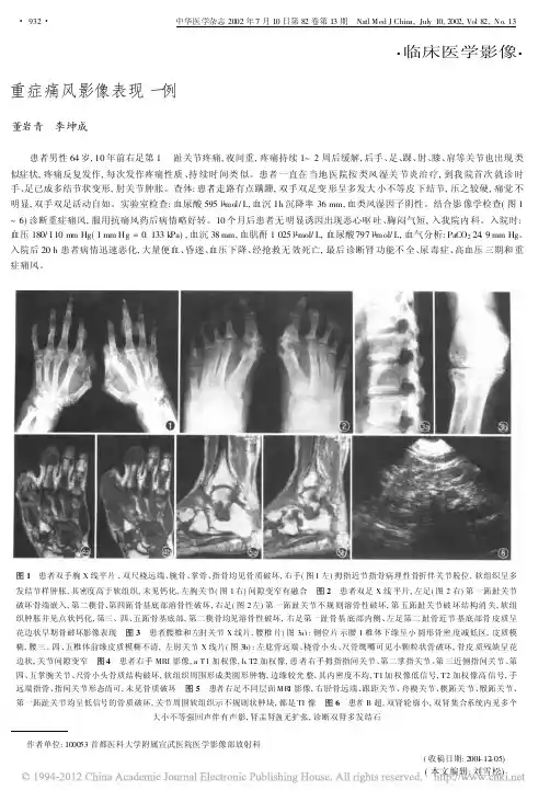 重症痛风影像表现一例